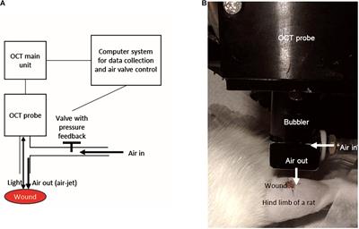 Indentation Stiffness Measurement by an Optical Coherence Tomography-Based Air-Jet Indentation System Can Reflect Type I Collagen Abundance and Organisation in Diabetic Wounds